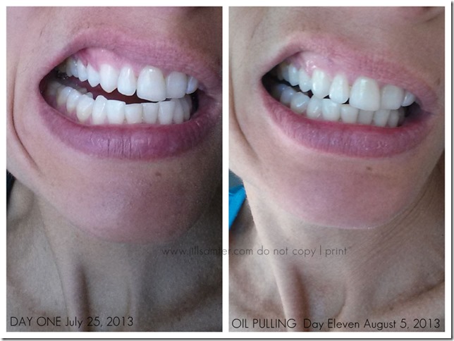 oil pulling before and after